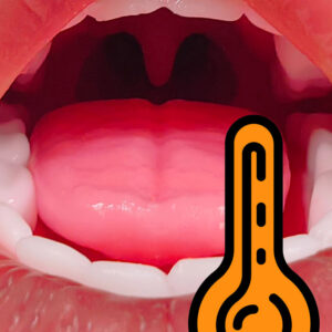 Oral Heating